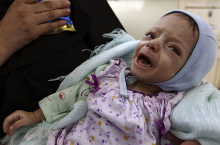 Yémen: un premier avion d’aide médicale du CICR atterrit à Sanaa.