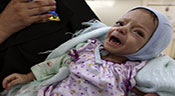 Yémen: un premier avion d’aide médicale du CICR atterrit à Sanaa
