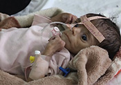Quelque 19 millions Yéménites menacés de famine, prévient l’ONU
