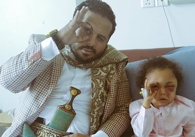 Yémen: pour les yeux de Buthaina