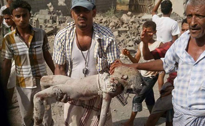#Yémen: l’#Arabie sur une liste noire de l’#ONU pour meurtres d’enfants