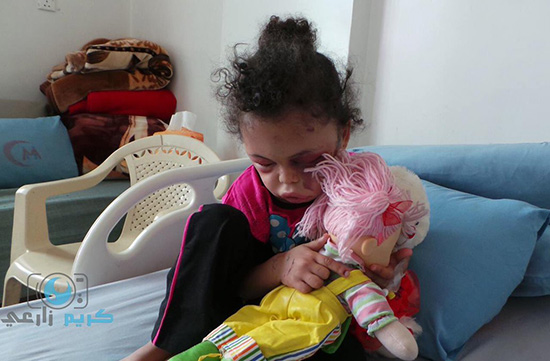 Yémen: Après un bombardement saoudien, une petite fille est la seule survivante d’une famille