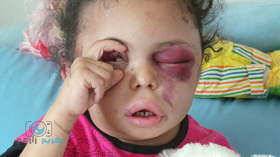 Yémen: Après un bombardement saoudien, une petite fille est la seule survivante d’une famille