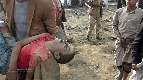 Nouveau massacre saoudien au Yémen: 12 civils tombés en martyre.