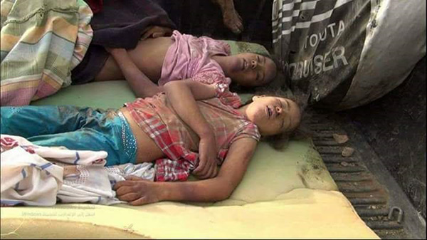 Nouveau massacre saoudien au Yémen: 12 civils tombés en martyre.