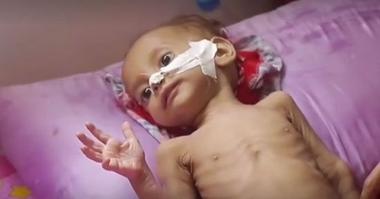 Des agences préviennent que la situation humanitaire s'aggrave au Yémen