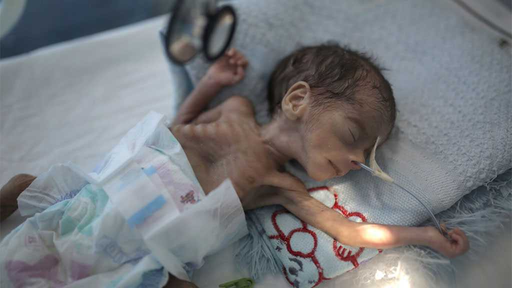 Embargo saoudien contre le Yémen: plus de 3 000 enfants atteints de cancer risquent de mourir
