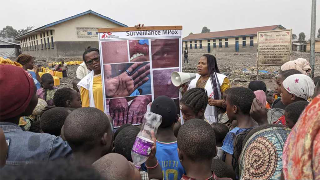 Mpox: L’OMS déclenche son plus haut niveau d’alerte mondiale