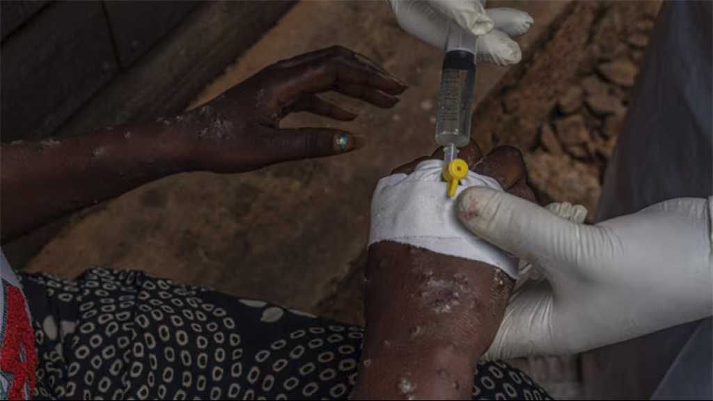 Mpox: Les premiers vaccins en RDC «ces prochains jours», selon le chef de l’OMS